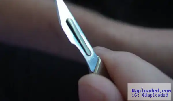 Amateur Surgeon Removes Man